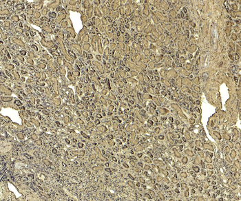 Goat anti-TRPM7 / LTRPC7 Antibody