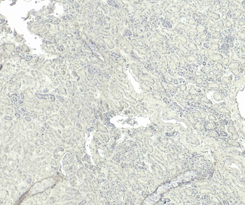 Goat anti-TRPM7 / LTRPC7 Antibody