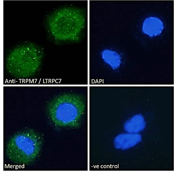 Goat anti-TRPM7 / LTRPC7 Antibody