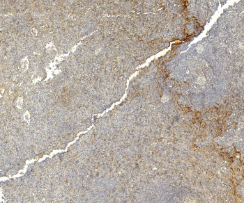 IRF5 Antibody