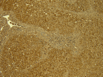 Goat anti-STAT3 (isoform 1 and 2) Antibody