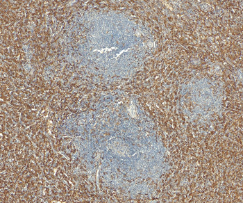 AIF1/IBA1 isoform 1 and 3