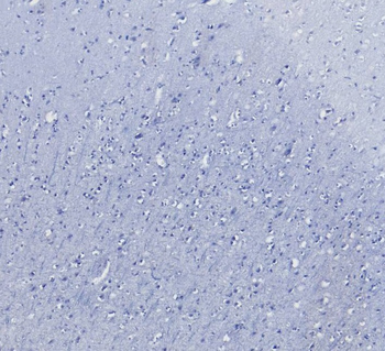 AIF1/IBA1 isoform 1 and 3