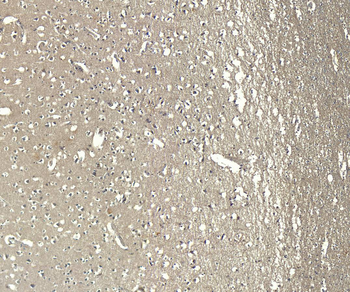 AIF1/IBA1 isoform 1 and 3