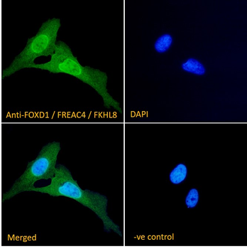 FOXD1/FREAC4/FKHL8 Antibody