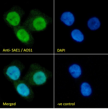 Goat anti-SAE1 / AOS1 Antibody