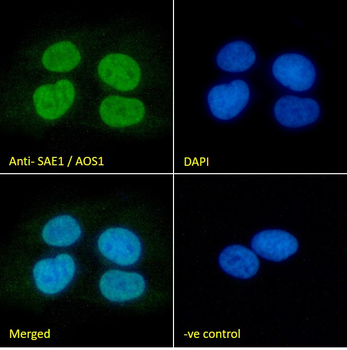 Goat anti-SAE1 / AOS1 Antibody