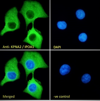 Goat anti-KPNA2 / IPOA1 Antibody