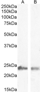 Goat anti-SM22 Alpha / Transgelin Antibody