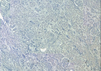 SIRT4 antibody