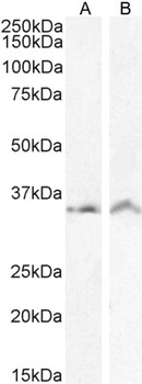 Goat anti-VDAC2 (C Terminus) Antibody
