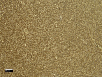 VDAC2 antibody