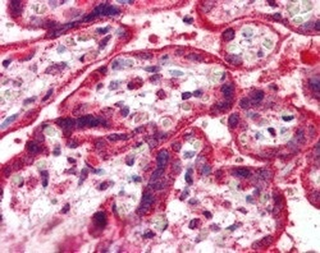 NEIL1/NEH1 Antibody