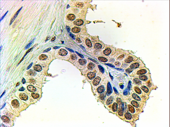 Goat anti-Androgen Receptor Antibody