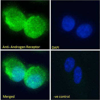 Goat anti-Androgen Receptor Antibody
