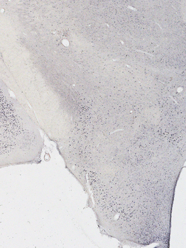 Goat anti-Androgen Receptor Antibody