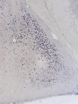 Goat anti-Androgen Receptor Antibody