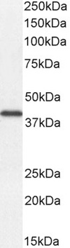 Goat anti-DKK1 Antibody