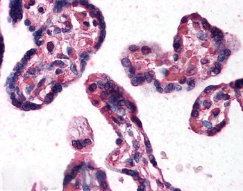 Goat anti-DKK1 Antibody