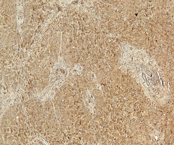 Goat anti-58KGolgi protein(Internal)/FTCD Antibody