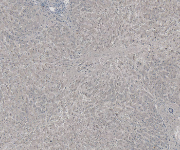 Goat anti-58KGolgi protein(Internal)/FTCD Antibody
