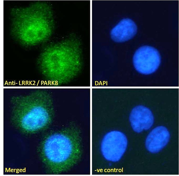 Goat anti-LRRK2 / PARK8 (near C Terminus) Antibody