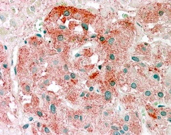 Goat anti-SEMA3E Antibody