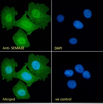 Goat anti-SEMA3E Antibody