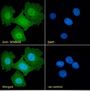 SEMA3E antibody