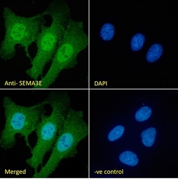 Goat anti-SEMA3E Antibody