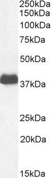 Goat anti-CD32 / FCGR2B Antibody