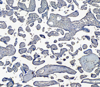 Goat anti-ENPP1 / PC1 Antibody
