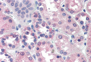 Goat anti-PCK1 / PEPCKC (internal) Antibody
