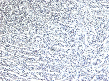 Goat anti-ADRB1 Antibody