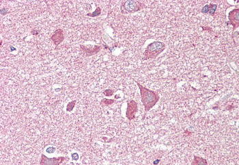 NCAM2 / OCAM