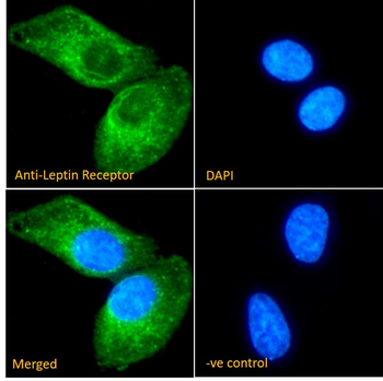 Goat anti-Leptin Receptor Antibody