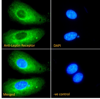 Goat anti-Leptin Receptor Antibody