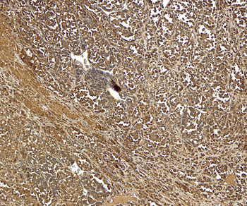 Goat anti-Silver homologue / Pmel 17 (C-terminus) Antibody