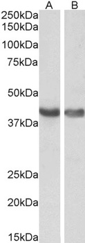 HEXIM1 antibody