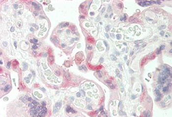 TGM2