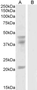 Goat anti-GABPB2 Antibody