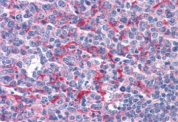 GABPB2 antibody