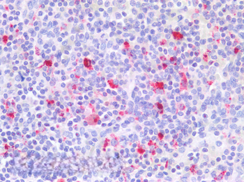 ITGB2/LFA-1 (aa86-99) Antibody