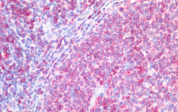 CD74 Antibody