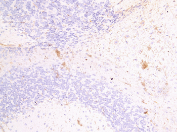 Fascin 2 Antibody