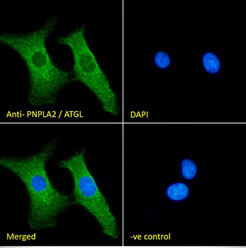 PNPLA2/ATGL Antibody