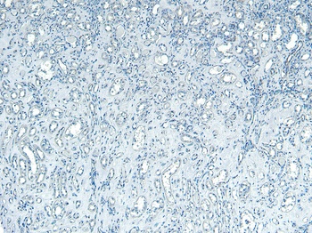PNPLA3 antibody
