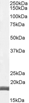 Goat Anti-AIF1/IBA1 isoform 1 and 3 (Human reactivity only) Antibody