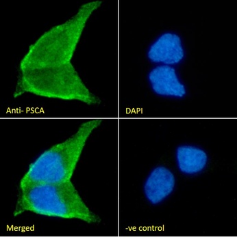 PSCA antibody