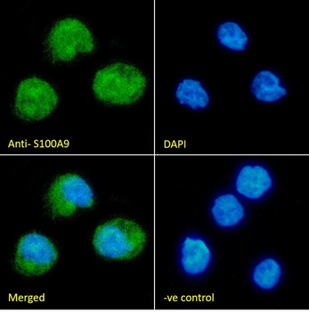 Goat anti-S100A9 Antibody